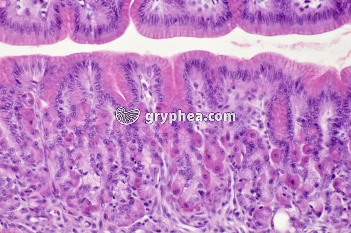 Estomac pylorique x100 - gryphea.org